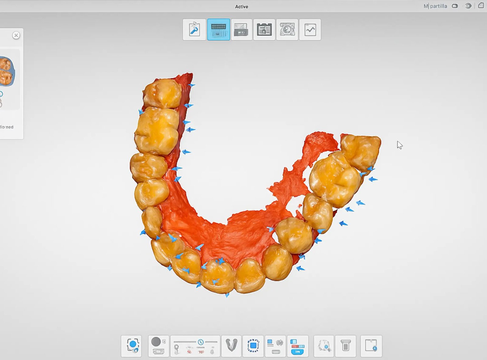 Diseño de Sonrisa Digital